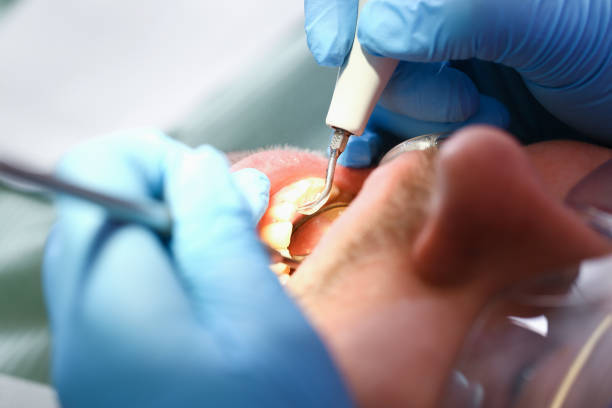 Best Emergency Denture Repair in Norwich, NY