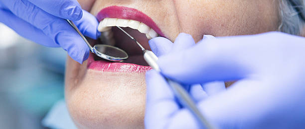 Best Emergency Denture Repair in Norwich, NY